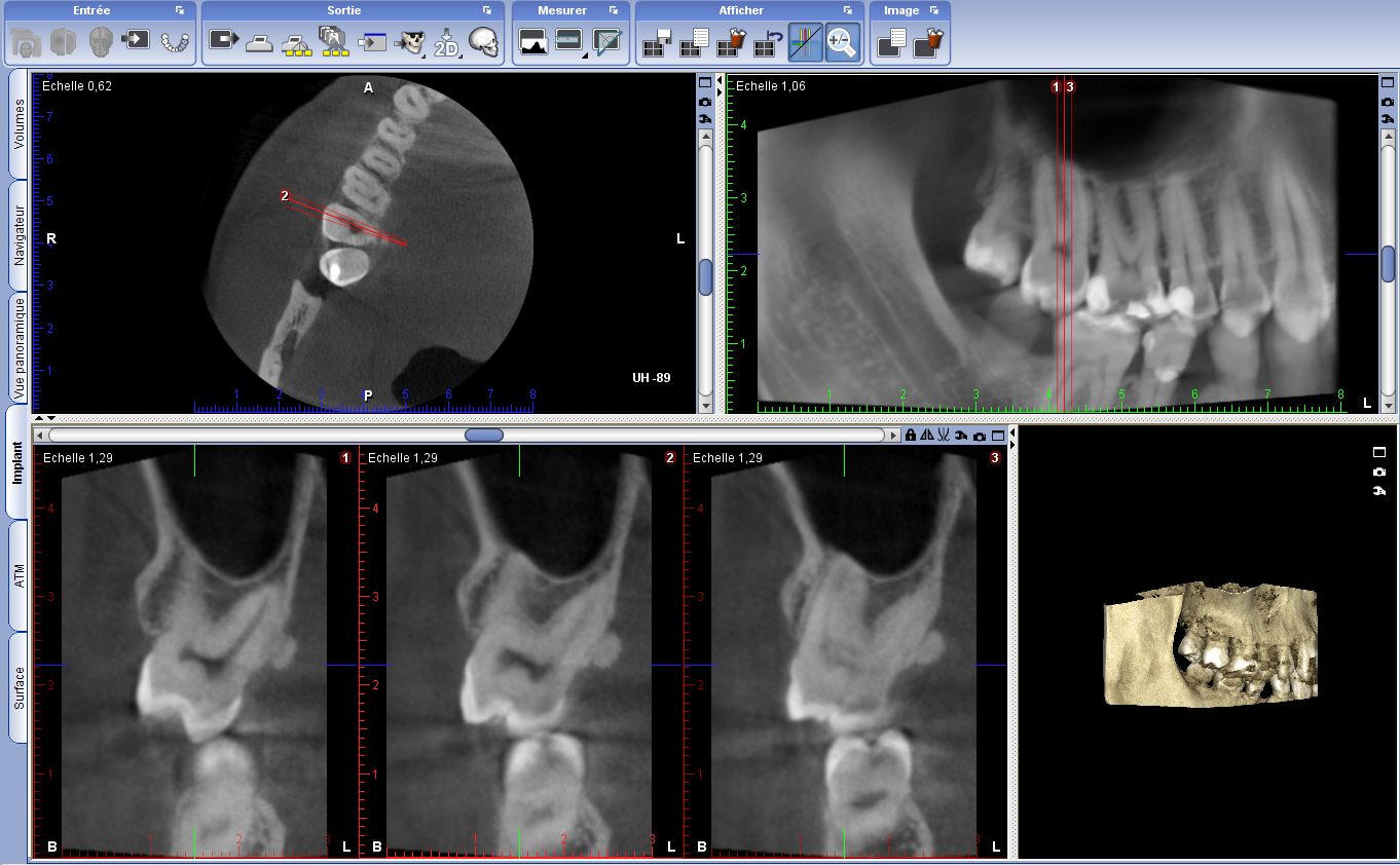 Examen Radiologie Dentaire Radiologie Abbeville